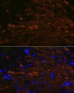 Myosin heavy chain 11 Rabbit anti-Human, Mouse, Rat, Clone: 8A8J4, Novus Biologicals 100 &mu;g | Buy Online | Novus Biologicals | Fisher Scientific