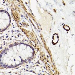 Myosin heavy chain 11 Rabbit anti-Human, Mouse, Rat, Clone: 8A8J4, Novus Biologicals 100 &mu;g | Buy Online | Novus Biologicals | Fisher Scientific