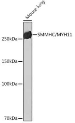 Myosin heavy chain 11 Rabbit anti-Human, Mouse, Rat, Clone: 8A8J4, Novus Biologicals 100 &mu;g | Buy Online | Novus Biologicals | Fisher Scientific
