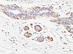 Myosin heavy chain 11 Antibody (MYH11/923), Novus Biologicals 0.2mg; Unlabeled:Antibodies,