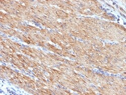 Myosin heavy chain 11 Antibody (MYH11/923), Novus Biologicals 0.2mg; Unlabeled:Antibodies,