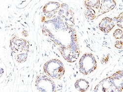 Myosin heavy chain 11 Antibody (SMMS-1), Novus Biologicals 0.2mg; Unlabeled:Antibodies,