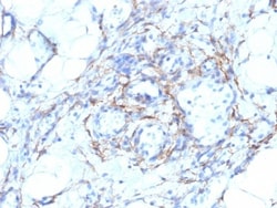 Myosin heavy chain 11 Antibody (MYH11/923 + SMMS-1), Novus Biologicals 0.2 mg | Buy Online | Novus Biologicals | Fisher Scientific