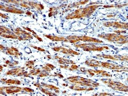 Myosin heavy chain 11 Antibody (MYH11/923 + SMMS-1), Novus Biologicals 0.2 mg | Buy Online | Novus Biologicals | Fisher Scientific