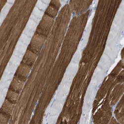 Myosin light chain 3 Antibody, Novus Biologicals:Antibodies:Primary Antibodies