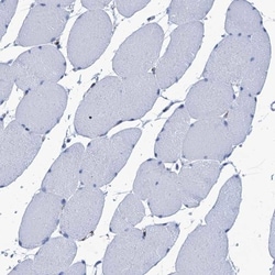 Myosin light chain kinase Antibody, Novus Biologicals 0.1mL; Unlabeled:Antibodies,