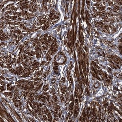 Myosin light chain kinase Antibody, Novus Biologicals 0.1mL; Unlabeled:Antibodies,