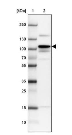 Myosin light chain kinase Antibody, Novus Biologicals 0.1mL; Unlabeled:Antibodies,