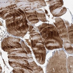 Myotilin Antibody, Novus Biologicals:Antibodies:Primary Antibodies