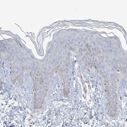 Myotilin Antibody, Novus Biologicals:Antibodies:Primary Antibodies