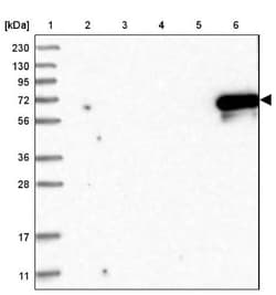 Myotilin Antibody, Novus Biologicals:Antibodies:Primary Antibodies