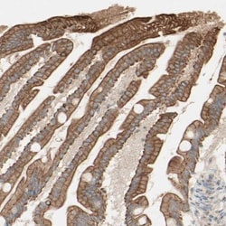 Myotubularin Antibody, Novus Biologicals 0.1mL; Unlabeled:Antibodies, Polyclonal