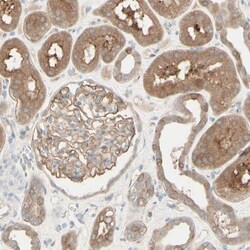 Myotubularin Antibody, Novus Biologicals:Antibodies:Primary Antibodies