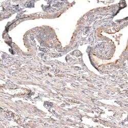 Myotubularin Antibody, Novus Biologicals:Antibodies:Primary Antibodies