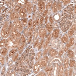 Myotubularin Antibody, Novus Biologicals:Antibodies:Primary Antibodies