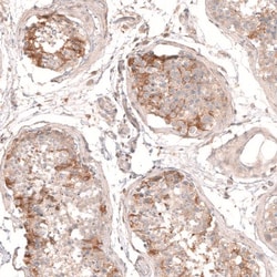 Myotubularin Antibody, Novus Biologicals:Antibodies:Primary Antibodies