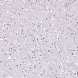 Myozenin 1 Antibody, Novus Biologicals:Antibodies:Primary Antibodies