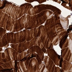 Myozenin 1 Antibody, Novus Biologicals:Antibodies:Primary Antibodies