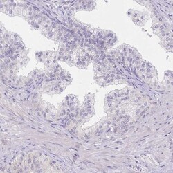 Myozenin 1 Antibody, Novus Biologicals 25 &mu;L, Unlabeled:Antibodies,
