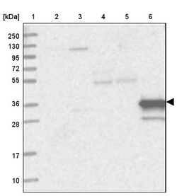 Myozenin 1 Antibody, Novus Biologicals 25 &mu;L, Unlabeled:Antibodies,