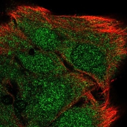 Myozenin 2 Antibody, Novus Biologicals 25 &mu;L; Unlabeled:Antibodies,
