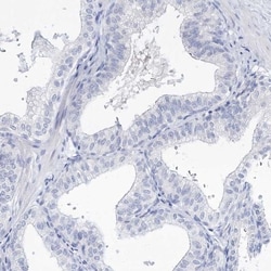 Myozenin 2 Antibody, Novus Biologicals 25 &mu;L; Unlabeled:Antibodies,