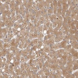 N-Acetylmannosamine Kinase/GNE Antibody, Novus Biologicals:Antibodies:Primary