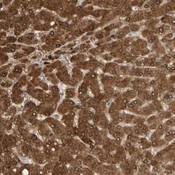N-Acetylmannosamine Kinase/GNE Antibody, Novus Biologicals 25 &mu;L; Unlabeled:Antibodies,