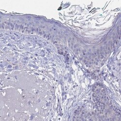 N-Cadherin Antibody, Novus Biologicals 25 &mu;L, Unlabeled:Antibodies,