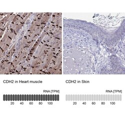N-Cadherin Antibody, Novus Biologicals 25 &mu;L, Unlabeled:Antibodies,
