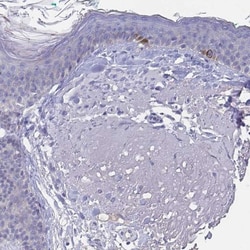 N-Cadherin Antibody, Novus Biologicals 25 &mu;L, Unlabeled:Antibodies,
