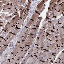N-Cadherin Antibody, Novus Biologicals 25 &mu;L, Unlabeled:Antibodies,