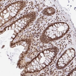 N-PAC Antibody, Novus Biologicals 25 &mu;L, Unlabeled:Antibodies, Polyclonal