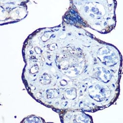 N-WASP Rabbit anti-Human, Mouse, Rat, Clone: 4P5M9, Novus Biologicals 20