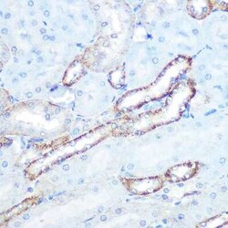 N-WASP Rabbit anti-Human, Mouse, Rat, Clone: 4P5M9, Novus Biologicals 20