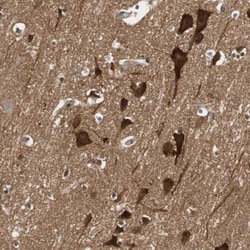N-WASP Antibody, Novus Biologicals 0.1mL; Unlabeled:Antibodies, Polyclonal