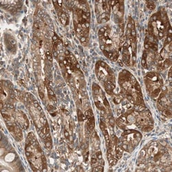 N-WASP Antibody, Novus Biologicals 0.1mL; Unlabeled:Antibodies, Polyclonal