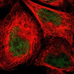 N myc interactor Antibody, Novus Biologicals:Antibodies:Primary Antibodies