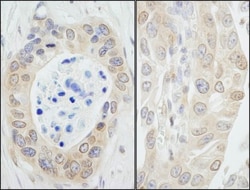N myc interactor Antibody, Novus Biologicals 0.1mL; Unlabeled:Antibodies,