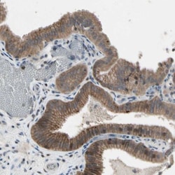 N myc interactor Antibody, Novus Biologicals:Antibodies:Primary Antibodies