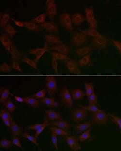 N4BP2 Rabbit anti-Human, Rat, Polyclonal, Novus Biologicals:Antibodies:Primary