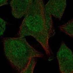 N4BP2 Rabbit anti-Human, Polyclonal, Novus Biologicals:Antibodies:Primary