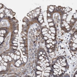 N4BP2 Antibody, Novus Biologicals:Antibodies:Primary Antibodies