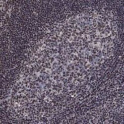 N4BP2 Rabbit anti-Human, Polyclonal, Novus Biologicals:Antibodies:Primary