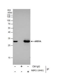 NAA10 Antibody, Novus Biologicals 0.1mL; Unlabeled:Antibodies, Polyclonal