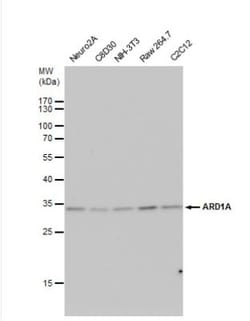 NAA10 Antibody, Novus Biologicals 0.1mL; Unlabeled:Antibodies, Polyclonal