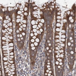 NAA25 Antibody, Novus Biologicals:Antibodies:Primary Antibodies