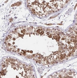NAALADase-2/NAALAD2 Antibody, Novus Biologicals:Antibodies:Primary Antibodies