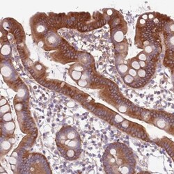 NAALADase-like 1/NAALADL1 Antibody, Novus Biologicals 0.1mL; Unlabeled:Antibodies,