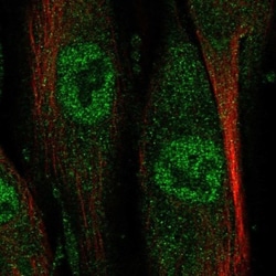 NAALADase-like 2/NAALADL2 Antibody, Novus Biologicals 0.1mL; Unlabeled:Antibodies,